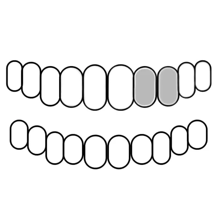 Bling Cartel Admin Rings 925 Sterling Silver Double Side Canine Teeth Caps Custom Grillz