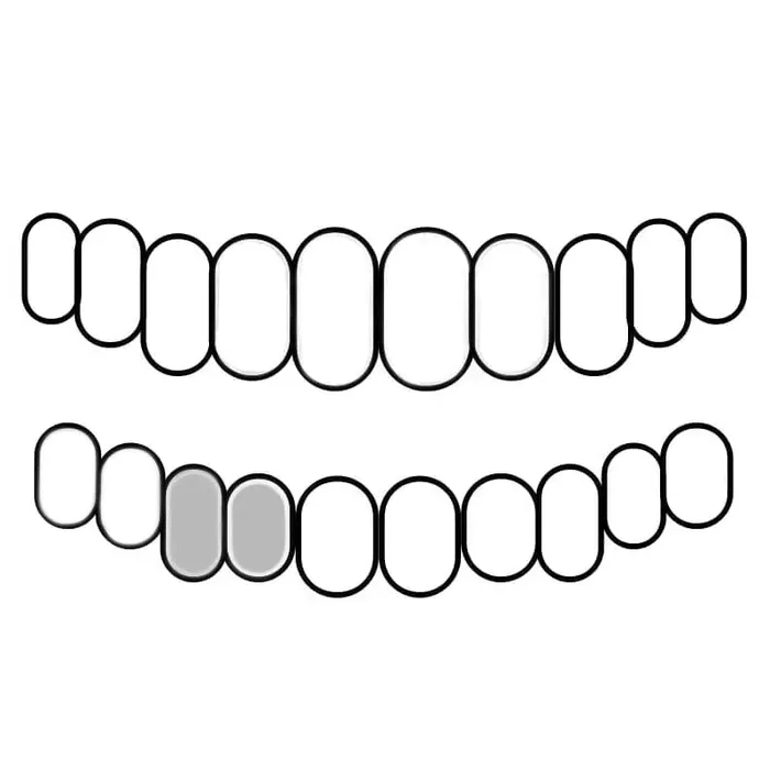 Bling Cartel Admin Rings 925 Sterling Silver Double Side Canine Teeth Caps Custom Grillz