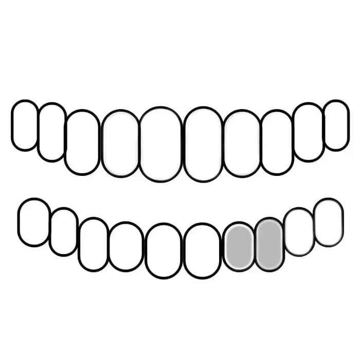 Bling Cartel Admin Rings 925 Sterling Silver Double Side Canine Teeth Caps Custom Grillz
