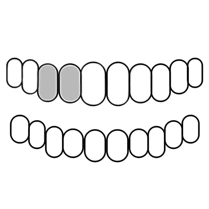 Bling Cartel Admin Rings 925 Sterling Silver Double Side Canine Teeth Caps Custom Grillz