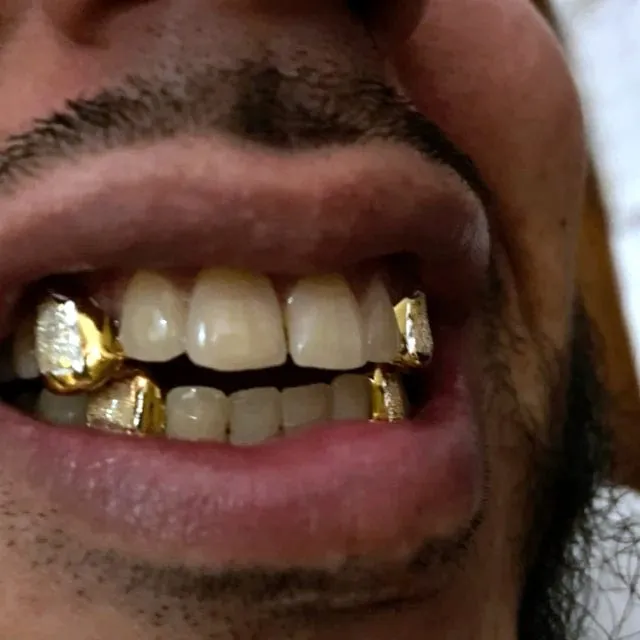 Bling Cartel Admin Rings Gold Plated over 925 Silver 2Tone Diamond Dust Custom Caps Single Grillz