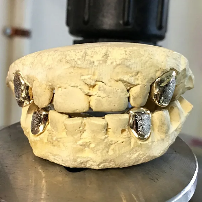 Bling Cartel Admin Rings Gold Plated over 925 Silver 2Tone Diamond Dust Custom Caps Single Grillz