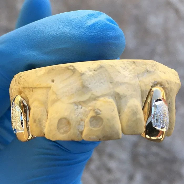 Bling Cartel Admin Rings Gold Plated over 925 Silver 2Tone Diamond Dust Custom Caps Single Grillz