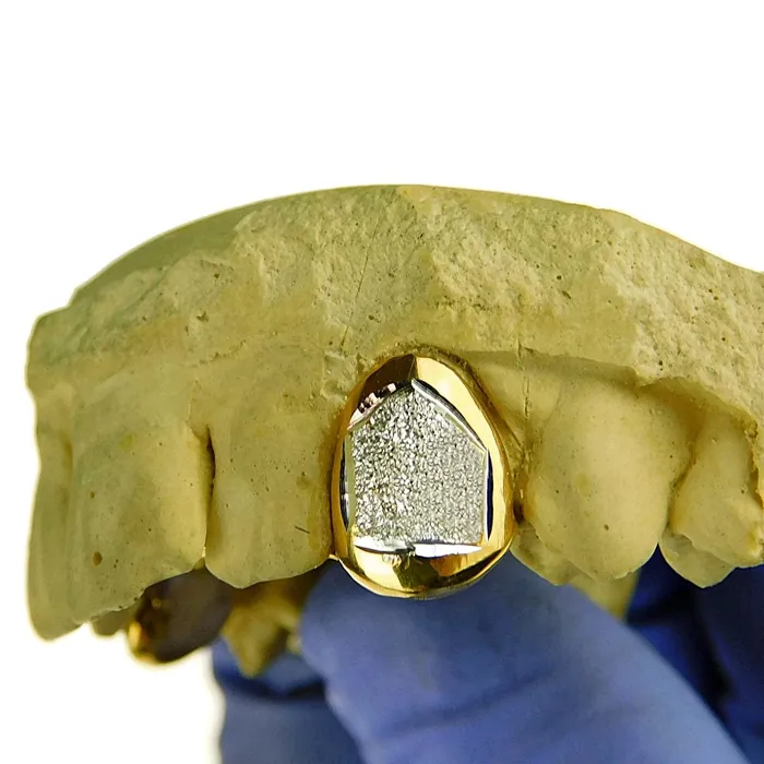 Bling Cartel Admin Rings Gold Plated over 925 Silver 2Tone Diamond Dust Custom Caps Single Grillz