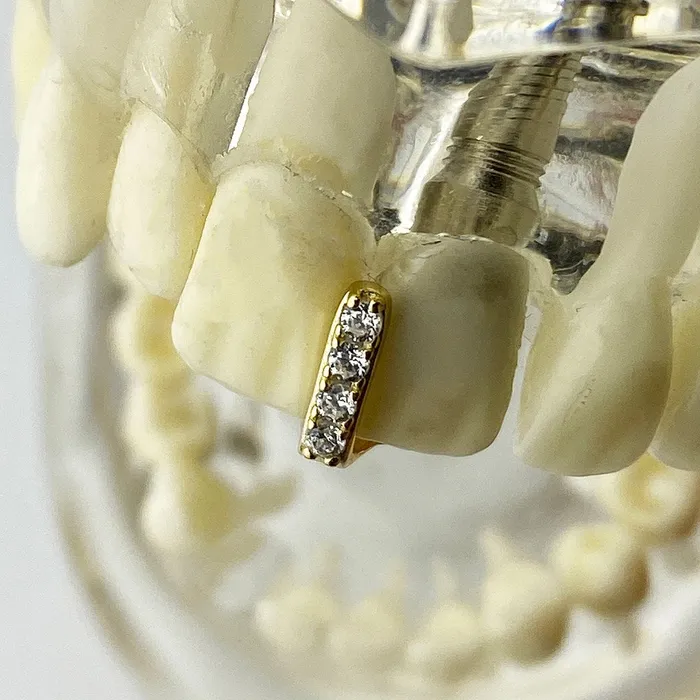 Gap Single Tooth Grillz Gold Finish Over 925 Sterling Silver Iced CZ Bling Cartel Admin Earrings