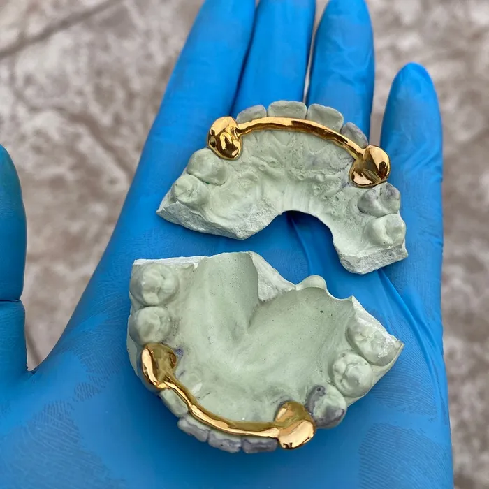 Gold Plated over 925 Sterling Silver Custom Single Teeth Caps Bling Cartel Admin Rings