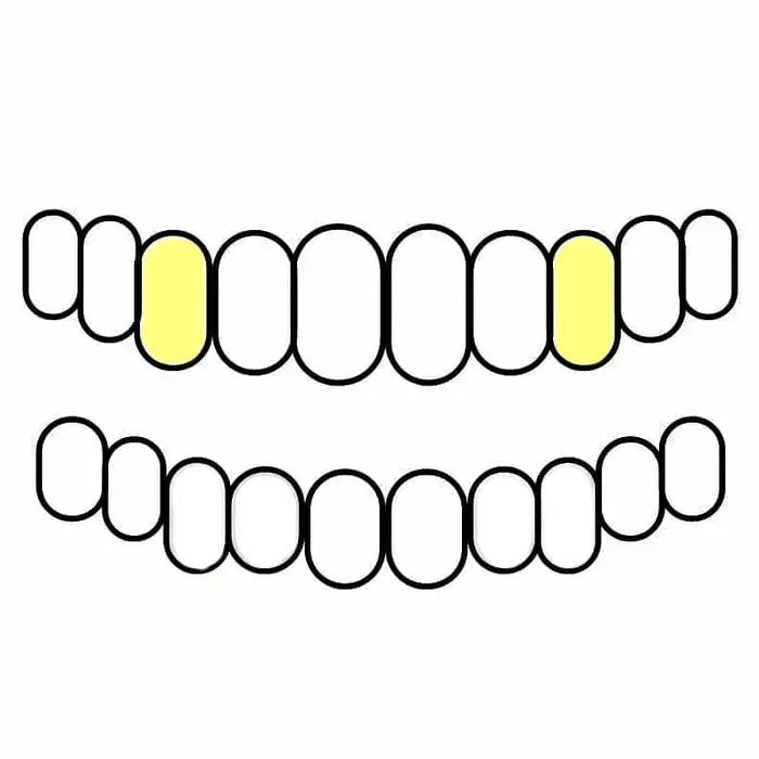 Gold Plated over 925 Sterling Silver Custom Single Teeth Caps Bling Cartel Admin Rings