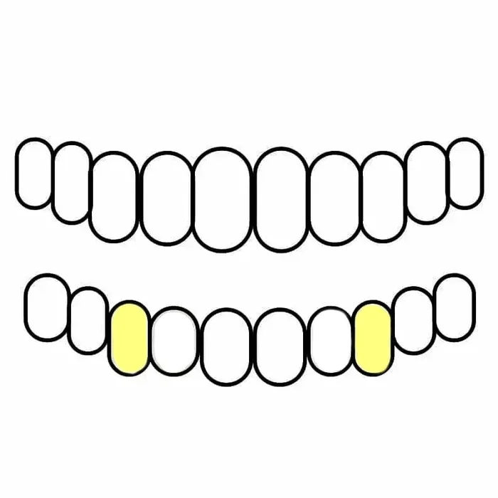 Gold Plated over 925 Sterling Silver Custom Single Teeth Caps Bling Cartel Admin Rings