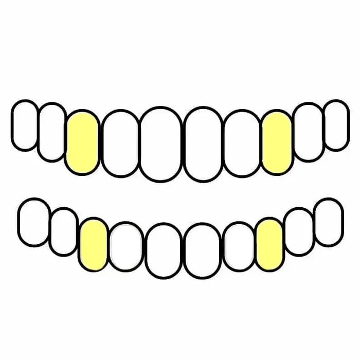 Gold Plated over 925 Sterling Silver Custom Single Teeth Caps Bling Cartel Admin Rings