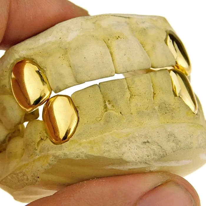 Gold Plated over 925 Sterling Silver Custom Single Teeth Caps Bling Cartel Admin Rings
