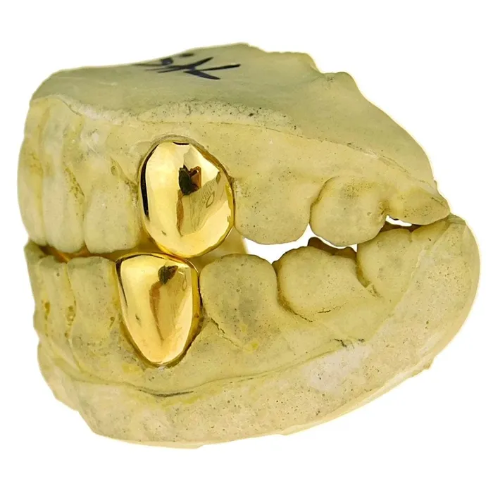 Gold Plated over 925 Sterling Silver Custom Single Teeth Caps Bling Cartel Admin Rings