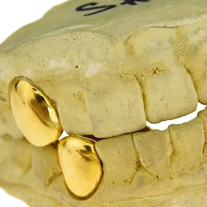 Gold Plated over 925 Sterling Silver Custom Single Teeth Caps Bling Cartel Admin Rings