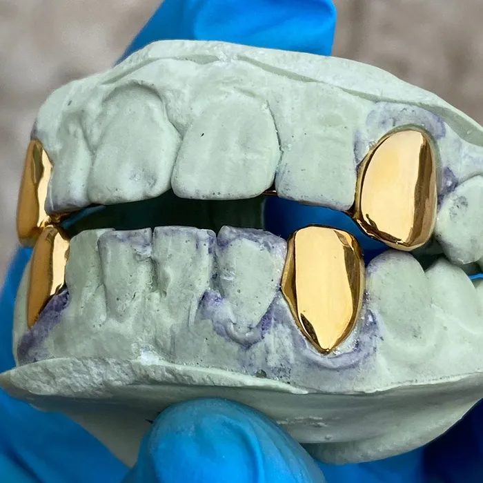 Gold Plated over 925 Sterling Silver Custom Single Teeth Caps Bling Cartel Admin Rings