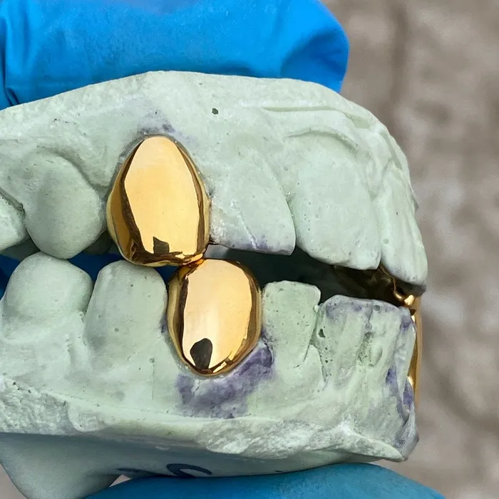 Gold Plated over 925 Sterling Silver Custom Single Teeth Caps Bling Cartel Admin Rings