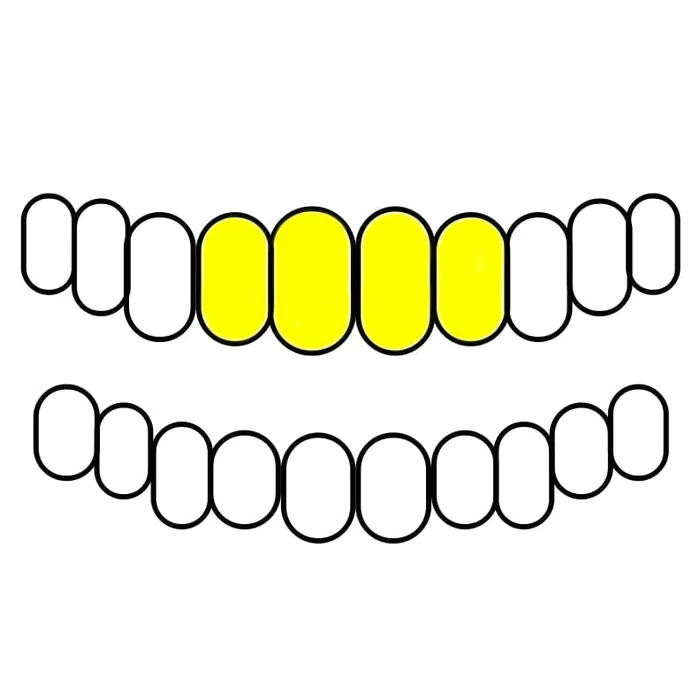 Real Solid 10K Gold or 14K Gold Teeth Permanent Cuts Perm Custom Grillz Bling Cartel PreStyled Sets