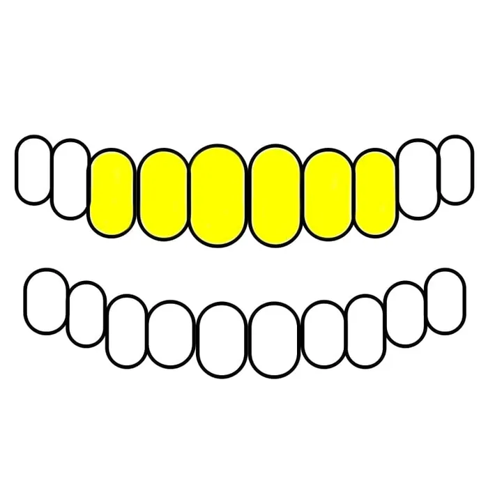 Real Solid 10K Gold or 14K Gold Teeth Permanent Cuts Perm Custom Grillz Bling Cartel PreStyled Sets