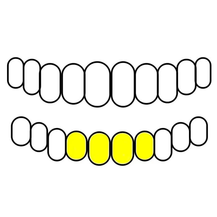 Real Solid 10K Gold or 14K Gold Teeth Permanent Cuts Perm Custom Grillz Bling Cartel PreStyled Sets