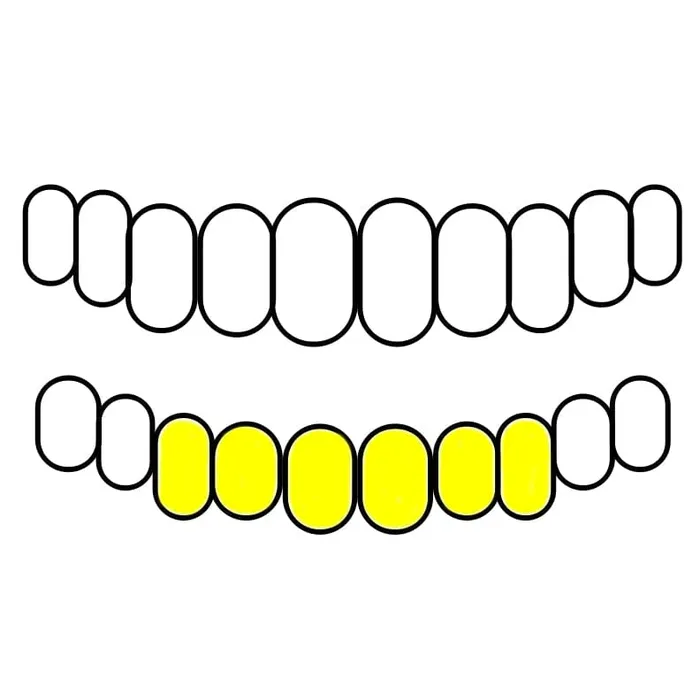 Real Solid 10K Gold or 14K Gold Teeth Permanent Cuts Perm Custom Grillz Bling Cartel PreStyled Sets