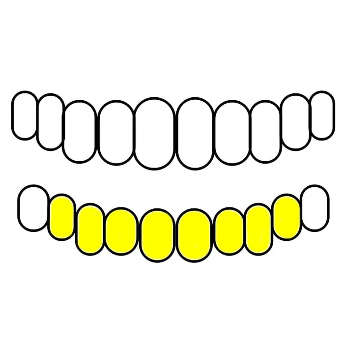 Real Solid 10K Gold or 14K Gold Teeth Permanent Cuts Perm Custom Grillz Bling Cartel PreStyled Sets