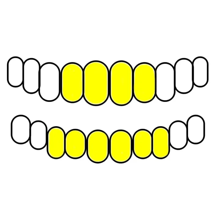 Real Solid 10K Gold or 14K Gold Teeth Permanent Cuts Perm Custom Grillz Bling Cartel PreStyled Sets