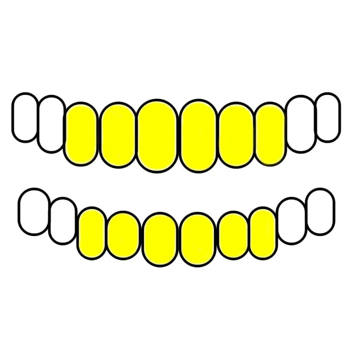 Real Solid 10K Gold or 14K Gold Teeth Permanent Cuts Perm Custom Grillz Bling Cartel PreStyled Sets