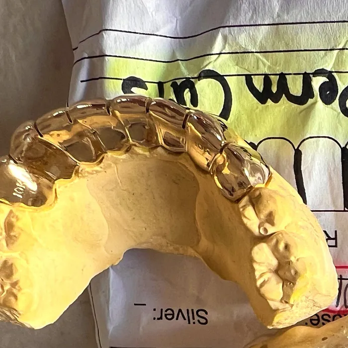 Real Solid 10K Gold or 14K Gold Teeth Permanent Cuts Perm Custom Grillz Bling Cartel PreStyled Sets