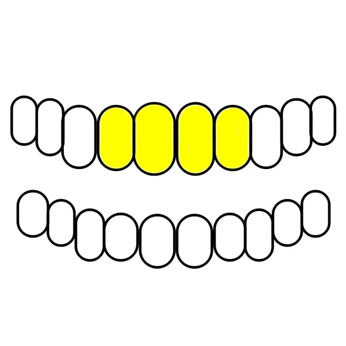 Real Solid 14K Gold TwoTone DiamondDust Custom Grillz Bling Cartel Admin Rings
