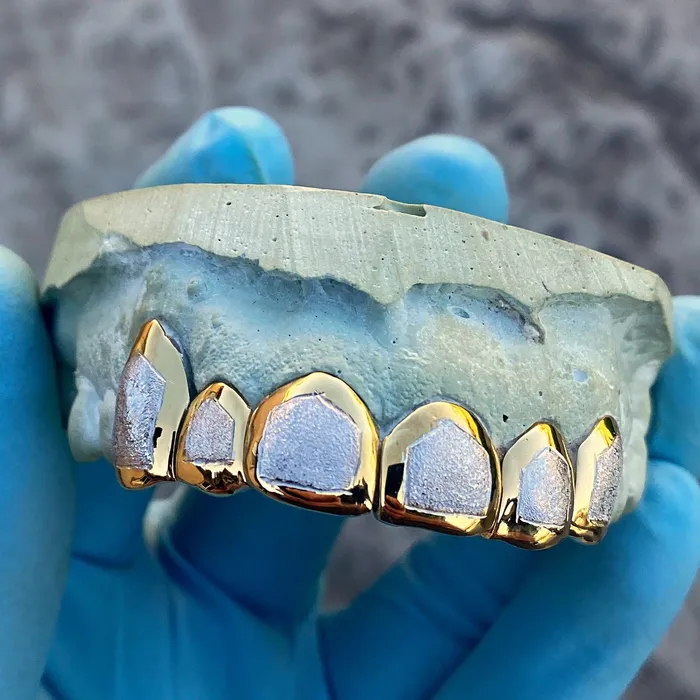 Real Solid 14K Gold TwoTone DiamondDust Custom Grillz Bling Cartel Admin Rings
