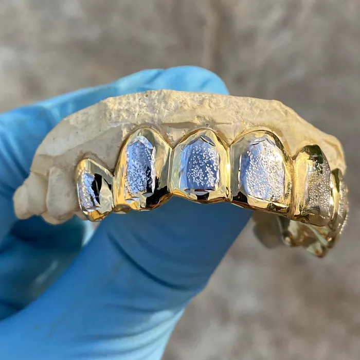 Real Solid 14K Gold TwoTone DiamondDust Custom Grillz Bling Cartel Admin Rings