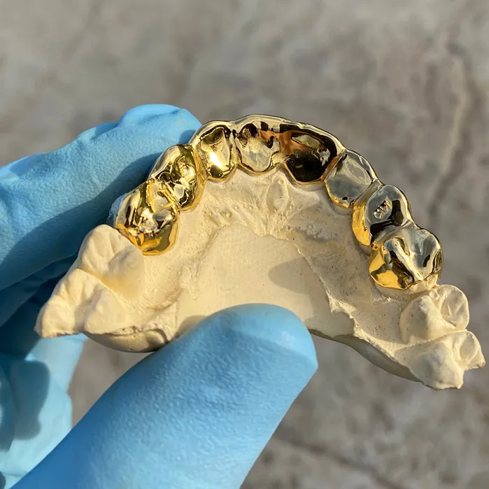 Real Solid 14K Gold TwoTone DiamondDust Custom Grillz Bling Cartel Admin Rings