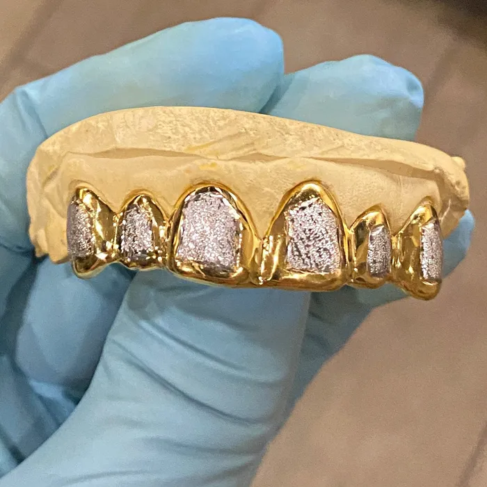 Real Solid 14K Gold TwoTone DiamondDust Custom Grillz Bling Cartel Admin Rings